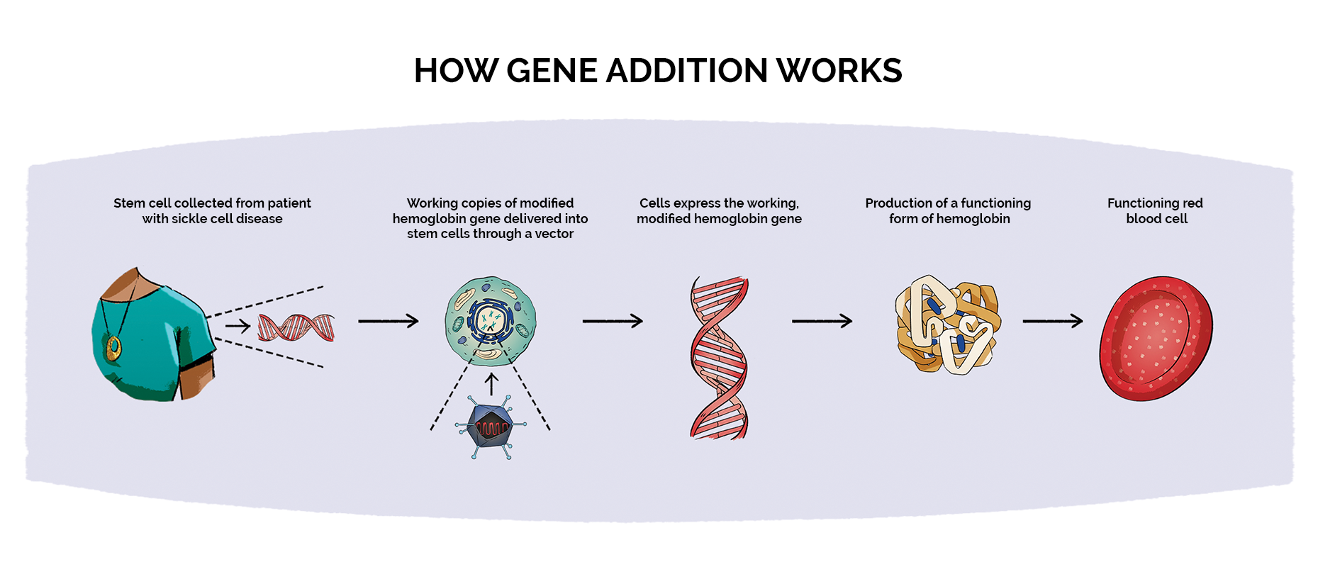 How gene addition works for sickle cell disease